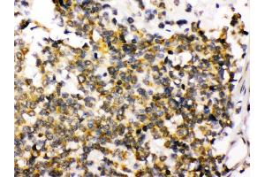 Immunohistochemistry (Paraffin-embedded Sections) (IHC (p)) image for anti-Discs, Large Homolog 4 (Drosophila) (DLG4) (AA 581-724) antibody (ABIN3043563)
