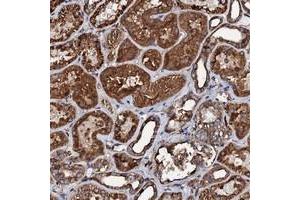 Immunohistochemical staining of human kidney with INTS10 polyclonal antibody  shows strong cytoplasmic and membranous positivity in tubular cells at 1:1000-1:2500 dilution. (INTS10 anticorps)