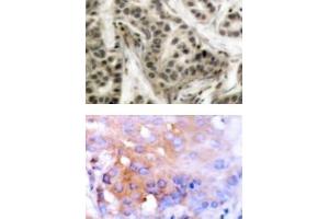 Image no. 2 for anti-Nuclear Factor of kappa Light Polypeptide Gene Enhancer in B-Cells 1 (NFKB1) (pSer337) antibody (ABIN318079)