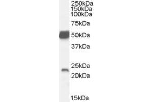 Western Blotting (WB) image for anti-Neurturin (NRTN) (C-Term) antibody (ABIN2466008) (Neurturin anticorps  (C-Term))