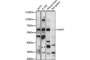 Western blot analysis of extracts of various cell lines, using HHAT antibody (ABIN7267598) at 1:1000 dilution. (HHAT anticorps  (AA 1-100))