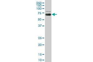 MGAT4A monoclonal antibody (M01), clone 8C5. (MGAT4A anticorps  (AA 436-535))