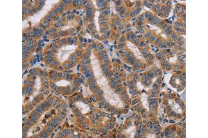 Immunohistochemistry (IHC) image for anti-Toll-Like Receptor 8 (TLR8) antibody (ABIN2422737) (TLR8 anticorps)