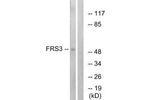 Western Blotting (WB) image for anti-Fibroblast Growth Factor Receptor Substrate 3 (FRS3) (Internal Region) antibody (ABIN1850386) (FRS3 anticorps  (Internal Region))