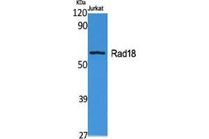 Western Blot (WB) analysis of specific cells using Rad18 Polyclonal Antibody. (RAD18 anticorps  (Internal Region))