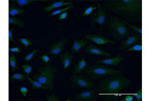 Immunofluorescence of monoclonal antibody to POLRMT on HeLa cell. (POLRMT anticorps  (AA 1121-1230))