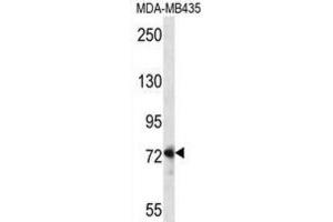 Western Blotting (WB) image for anti-Dishevelled Segment Polarity Protein 1 (DVL1) antibody (ABIN5016275) (DVL1 anticorps)