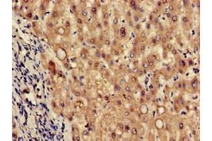 Immunohistochemistry of paraffin-embedded human liver tissue using ABIN7173617 at dilution of 1:100