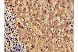 Immunohistochemistry of paraffin-embedded human liver tissue using ABIN7173617 at dilution of 1:100 (Tryptophan Hydroxylase 2 anticorps  (AA 44-225))
