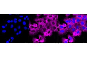 Immunocytochemical staining of HT- cells with LPP antibody (ABIN7799277), 1:1,000).