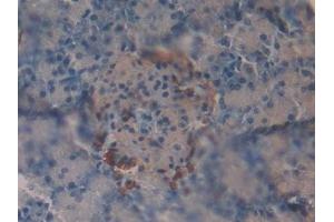 Detection of VIP in Mouse Pancreas Tissue using Polyclonal Antibody to Vasoactive Intestinal Peptide (VIP)