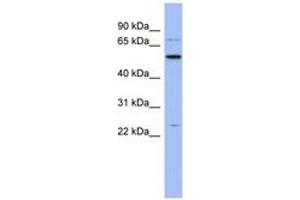 Image no. 1 for anti-Zinc Finger CCHC-Type and RNA Binding Motif 1 (ZCRB1) (N-Term) antibody (ABIN6743039) (ZCRB1 anticorps  (N-Term))