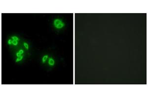 Immunofluorescence analysis of A549 cells, using TFIP8 antibody.