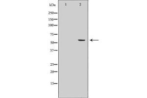 Western blot analysis of Cytochrome P450 19A1 Antibody expression in Human placenta tissue lysates. (Aromatase anticorps  (Internal Region))