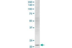 NDUFV2 monoclonal antibody (M03), clone 1A10.
