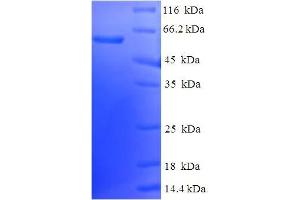 SDS-PAGE (SDS) image for Endoplasmic Reticulum Protein 44 (ERP44) (AA 30-406) protein (His-SUMO Tag) (ABIN5711749)