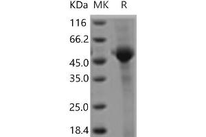 Western Blotting (WB) image for CD8a Molecule (CD8A) protein (Fc Tag) (ABIN7321149) (CD8 alpha Protein (Fc Tag))