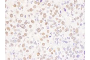 anti-Upstream Transcription Factor 2, C-Fos Interacting (USF2) (AA 1-50) antibody