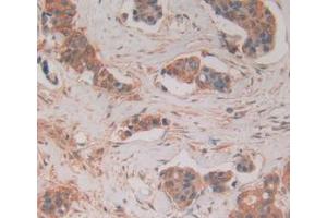 Figure. (FADD anticorps  (AA 12-206))