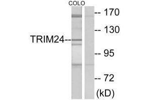 Western blot analysis of extracts from COLO cells, using TRIM24 antibody. (TRIM24 anticorps  (C-Term))