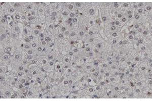 ABIN6267448 at 1/200 staining human Lymph nodes tissue sections by IHC-P.