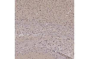 anti-RNA-Binding Protein NOB1 (NOB1) (AA 1-389) antibody