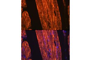 Immunofluorescence analysis of rat skeletal muscle using α-Actin-1  Rabbit mAb (ABIN3015986, ABIN3015987, ABIN1680683 and ABIN1680684) at dilution of 1:100 (40x lens). (Actin anticorps)