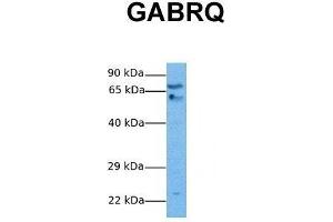 Host:  Rabbit  Target Name:  GABRQ  Sample Tissue:  Human Stomach Tumor  Antibody Dilution:  1. (GABRQ anticorps  (N-Term))