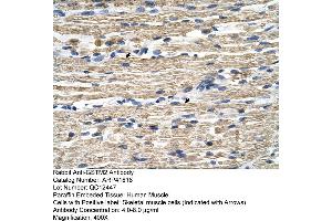 Rabbit Anti-GSTM2 Antibody  Paraffin Embedded Tissue: Human Muscle Cellular Data: Skeletal muscle cells Antibody Concentration: 4. (GSTM2 anticorps  (N-Term))