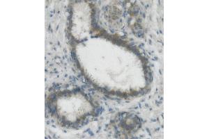 IHC analysis of Nectin 2/NECTIN2 using anti-Nectin 2/NECTIN2 antibody (ABIN7601304).