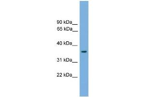 WB Suggested Anti-Foxf1a Antibody Titration: 0.