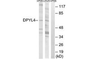 Western blot analysis of extracts from LOVO/HT-29 cells, using DPYSL4 Antibody. (DPYSL4 anticorps  (AA 91-140))