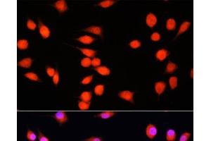 Immunofluorescence analysis of L929 cells using COMMD1 Polyclonal Antibody at dilution of 1:100. (COMMD1 anticorps)