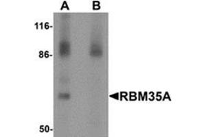 Western blot analysis of RBM35A in rat colon tissue lysate with RBM35A antibody at 0. (ESRP1 anticorps  (N-Term))