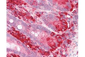Anti-TXNDC5 / ERP46 antibody IHC staining of human small intestine. (TXNDC5 anticorps  (AA 419-432))
