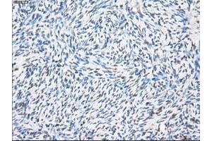 Image no. 8 for anti-Protein Phosphatase 5, Catalytic Subunit (PPP5C) antibody (ABIN1500391)