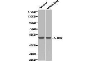 Western Blotting (WB) image for anti-Aldehyde Dehydrogenase 2 Family (Mitochondrial) (ALDH2) antibody (ABIN1870925) (ALDH2 anticorps)