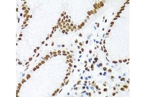 Immunohistochemistry of paraffin-embedded Human stomach using KHDRBS1 Polyclonal Antibody at dilution of 1:100 (40x lens).