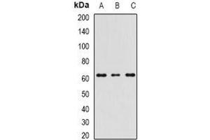 Western blot analysis of RIPK2 expression in MCF7 (A), mouse spleen (B), mouse testis (C) whole cell lysates. (RIPK2 anticorps)