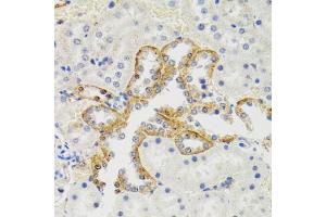 Immunohistochemistry of paraffin-embedded rat kidney using SH2B1 Antibody. (SH2B1 anticorps)
