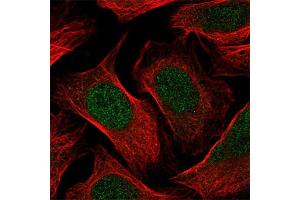 Immunofluorescent staining of human cell line U-2 OS with RBL1 polyclonal antibody  at 1-4 ug/mL concentration shows positivity in nucleus but excluded from the nucleoli. (p107 anticorps)