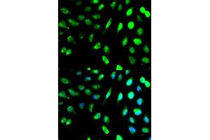 Immunofluorescence analysis of MCF7 cell using KLRD1 antibody.