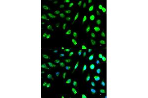 Immunofluorescence analysis of MCF7 cell using KLRD1 antibody. (CD94 anticorps  (AA 32-179))