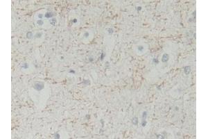 Detection of BLVRB in Human Cerebrum Tissue using Polyclonal Antibody to Biliverdin Reductase B (BLVRB) (BLVRB anticorps  (AA 2-206))