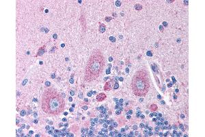Anti-GABRB2 antibody IHC of human brain, cerebellum.