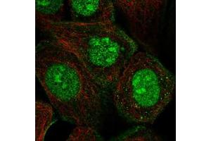 Immunofluorescent staining of human cell line A-431 with NT5C3L polyclonal antibody  at 1-4 ug/mL dilutions shows positivity in nucleus, nucleoli and cytoskeleton (actin filaments).