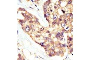 Image no. 2 for anti-Docking Protein 5 (DOK5) (N-Term) antibody (ABIN359962)