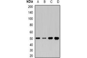 Western blot analysis of MOCS3 expression in HepG2 (A), Jurkat (B), mouse liver (C), rat heart (D) whole cell lysates. (MOCS3 anticorps)