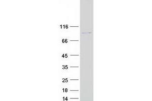 Validation with Western Blot