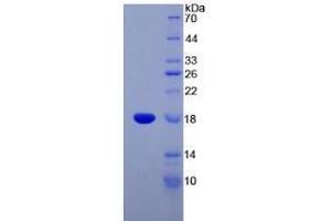 SDS-PAGE analysis of Human Somatostatin Protein. (Somatostatin Protein (SST))